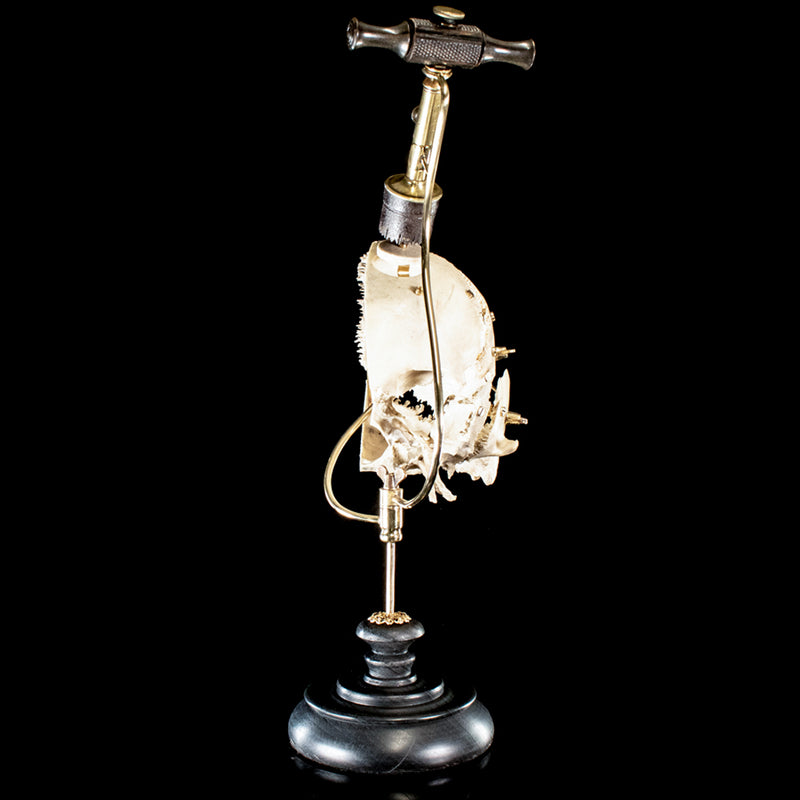 Antique Trephine mounted with real human skull