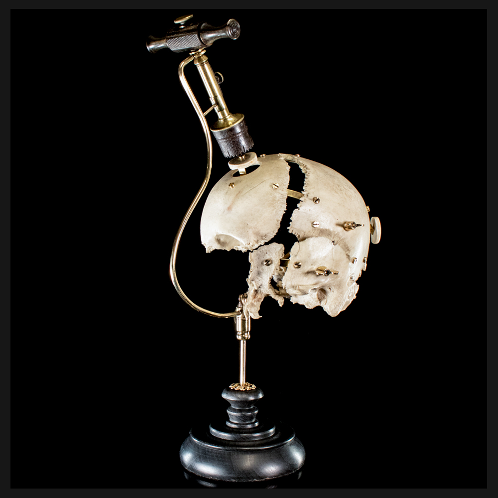 Real human skull, Trepanation, vintage trephine,