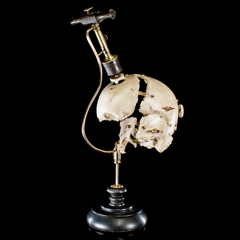 Antique Trephine mounted with real human skull