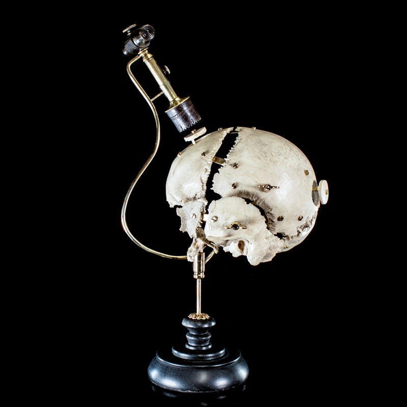 Antique Trephine mounted with real human skull