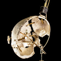 Antique Trephine mounted with real human skull