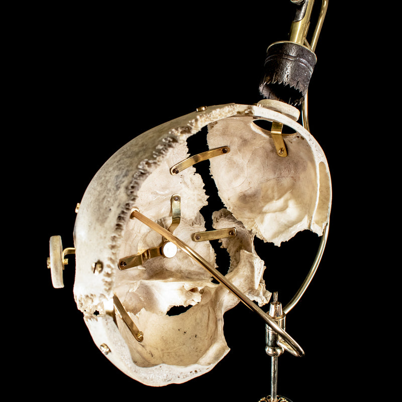 Antique Trephine mounted with real human skull