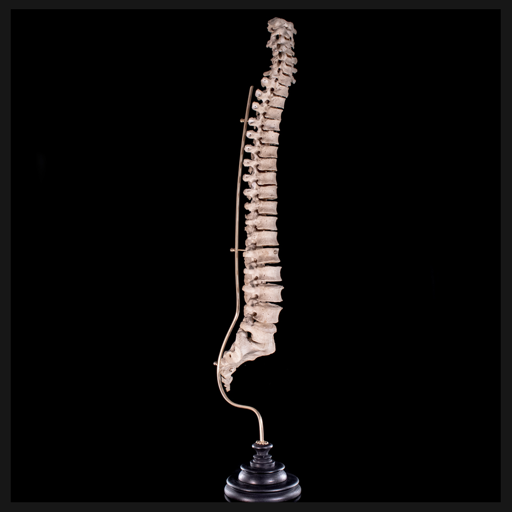 Real Human spine