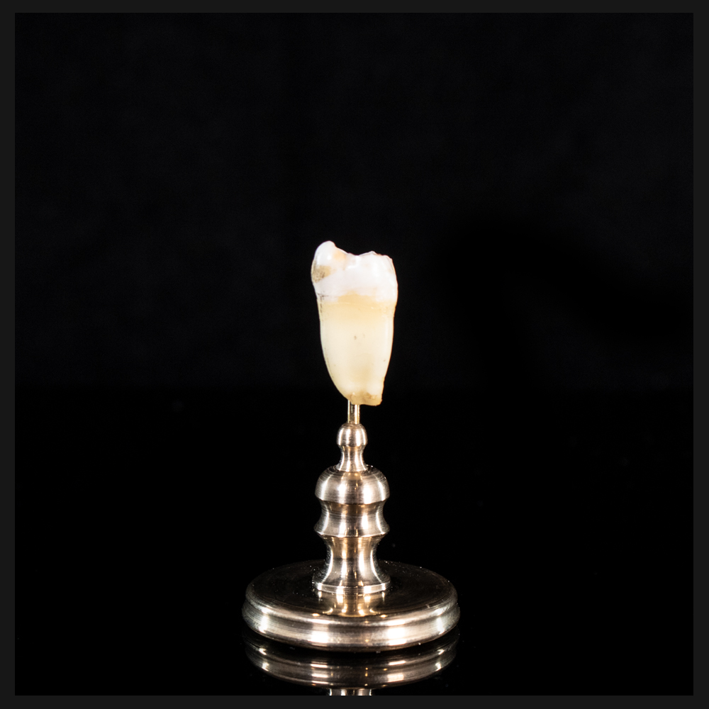 Human tooth with a filling, on custom brass base