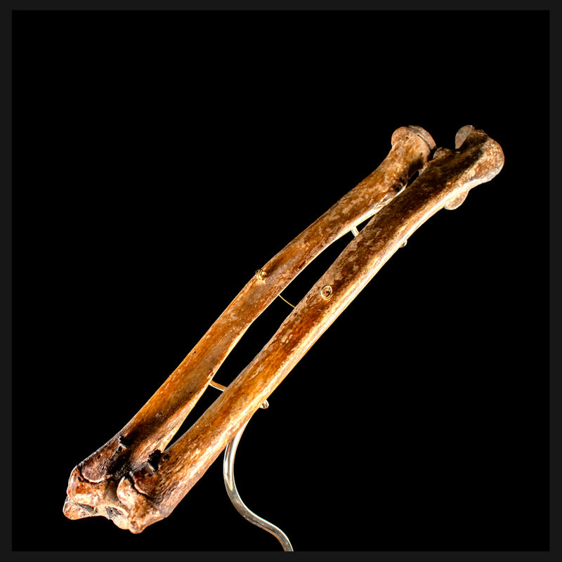 Real human radius and ulna