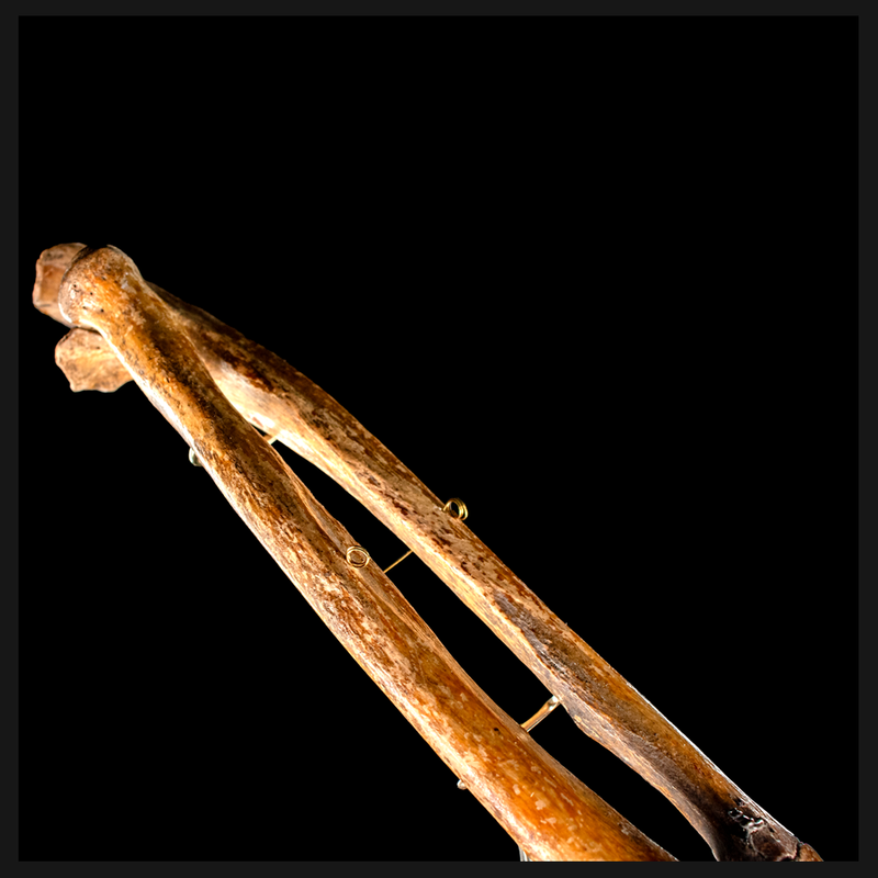 Real human radius and ulna