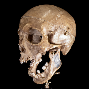 Human skull with moving mouth articulation